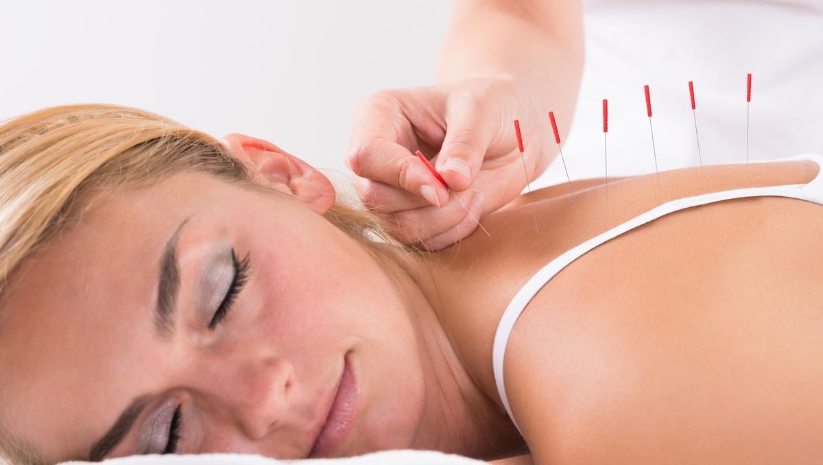 L&rsquo;acupuncture et l&rsquo;anxiété